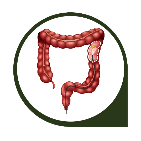 drmasoumi-Colon-cancer-01-min