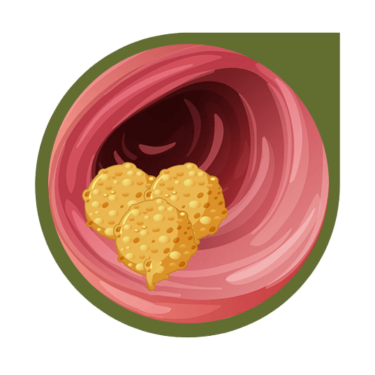 drmasoumi-Colon-cancer-02-min