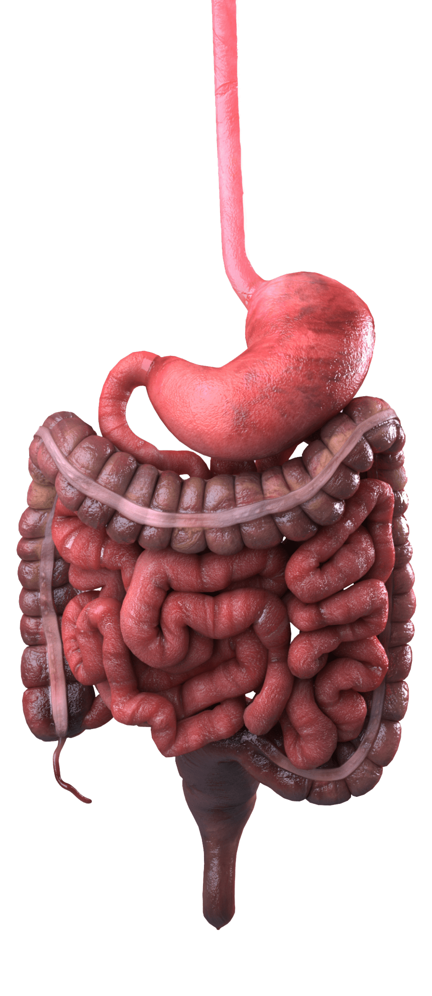 drmasoumi-Colon-cancer-04-png-min