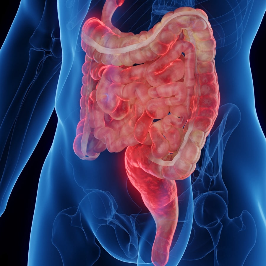 drghasemmasoumi-inflammatory-bowel-disease-ibd-02