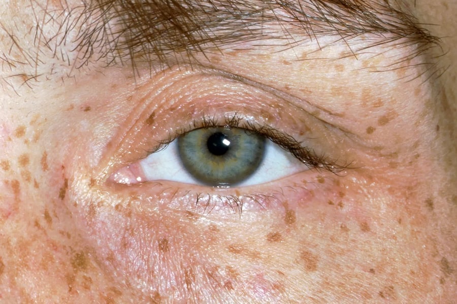 drghasemmasoumi-pancreatic-disease-04