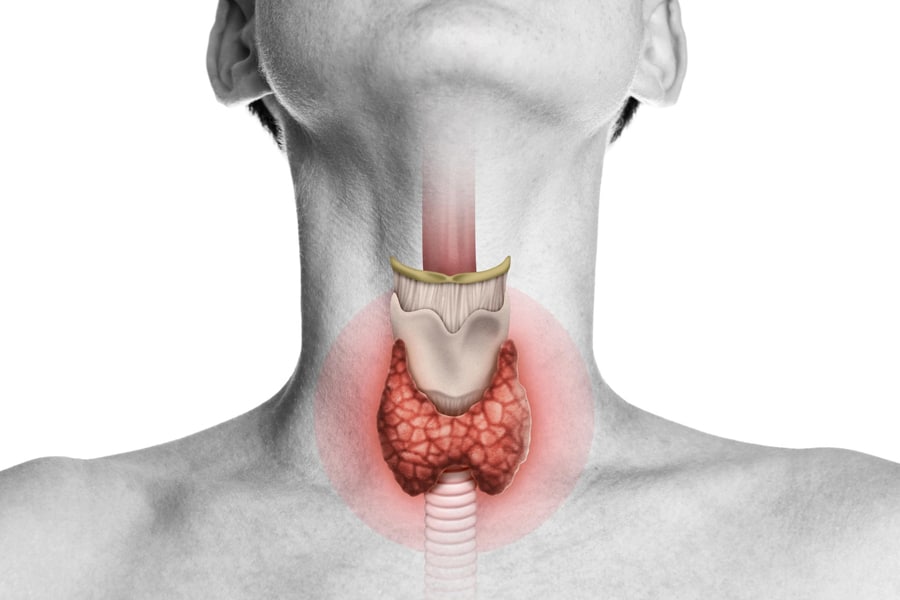 drghasemmasoumi-thyroid-diseases-02