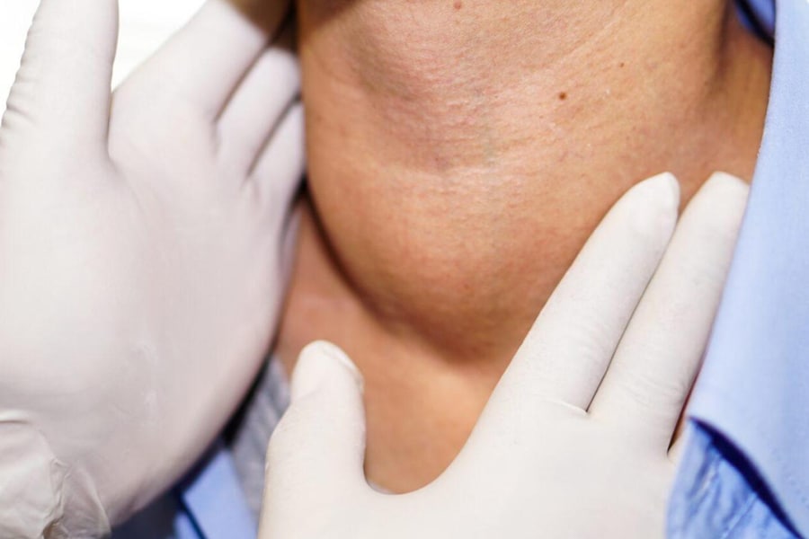 drghasemmasoumi-thyroid-diseases-03
