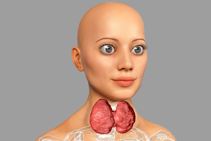 drghasemmasoumi-thyroid-diseases-05