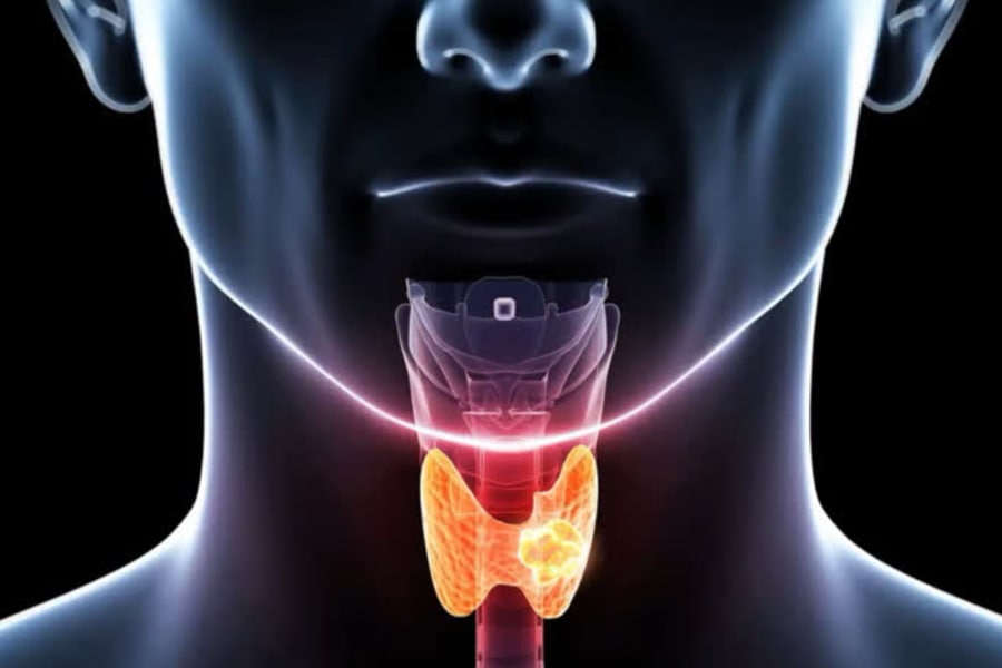 drghasemmasoumi-thyroid-diseases-06